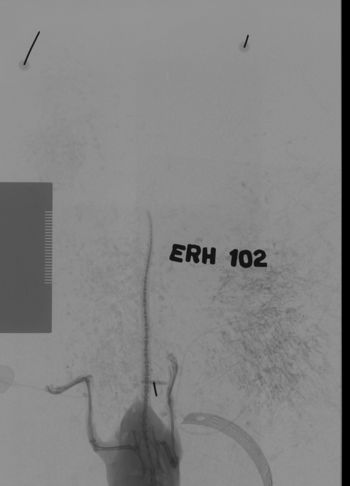 Media type: image;   Mammalogy 69540 Description: Xray of mouse.;